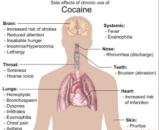 Side effects of chronic use of cocaine photo