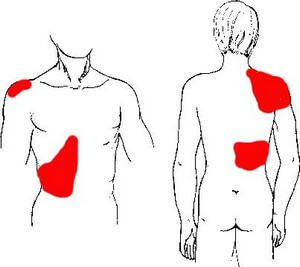 Location of gallbladder pain