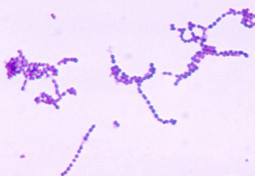 A closer look at S. pyogenes image photo picture