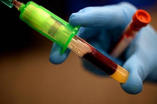 Blood testing is an invasive way of testing for substance abuse but yields to an accurate result, especially if testing for recent marijuana use image photo picture