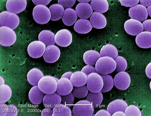 S. aureus bacteria are the common cause of impetigo image photo picture