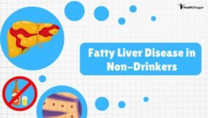 Fatty Liver Disease in Non-Drinkers
