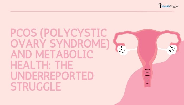 PCOS (Polycystic Ovary Syndrome) and Metabolic Health The Underreported Struggle